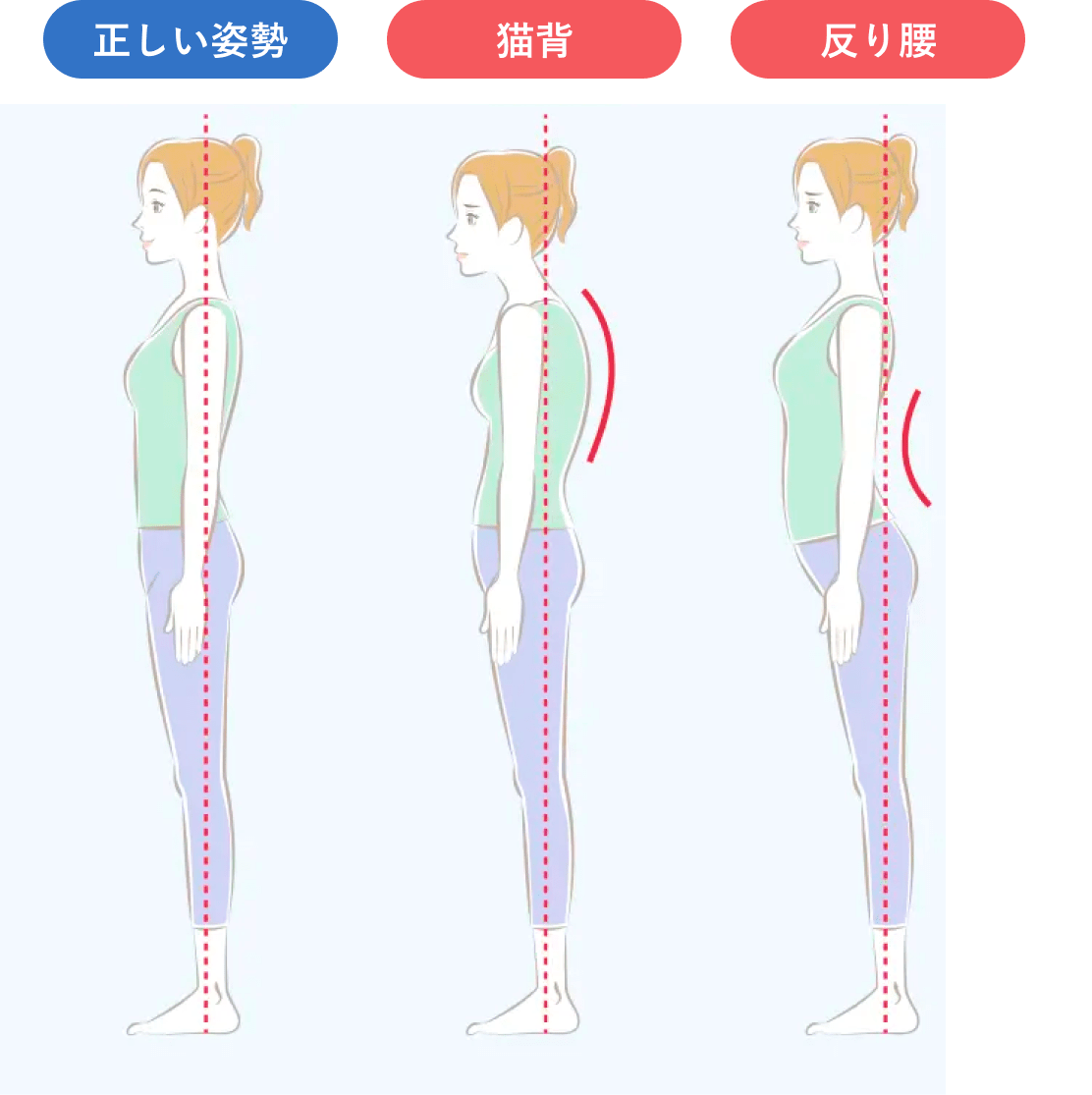正しい姿勢、猫背、反り腰のイラスト